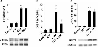 Inositol-Requiring Enzyme 1 Alpha Endoribonuclease Specific Inhibitor STF-083010 Alleviates Carbon Tetrachloride Induced Liver Injury and Liver Fibrosis in Mice